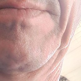 , , 56 