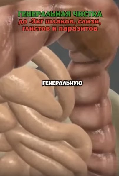 Данное мероприятие направлено на глубокое очищение кишечника
