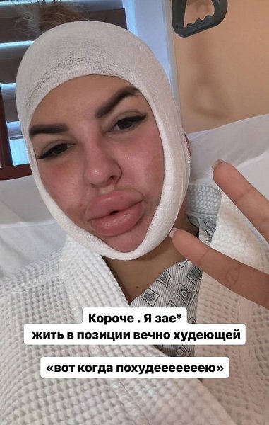 Звезда «Дома-2» Майя Донцова сделала липосакцию. Девушка, которая начала стремительно набирать вес ... - 3