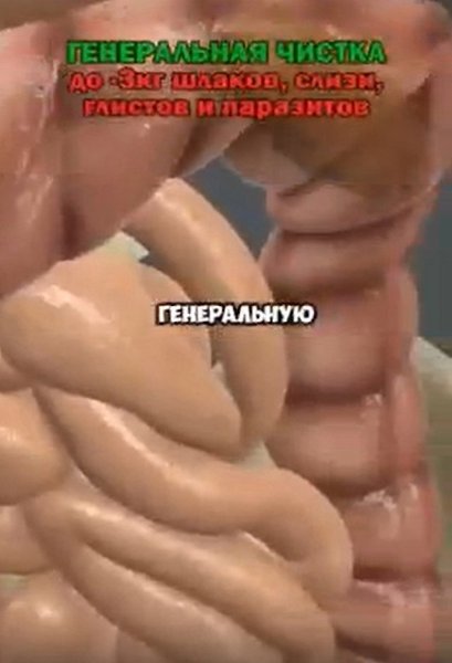    - 2