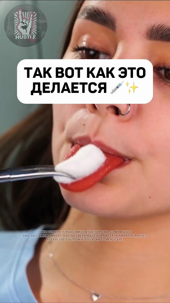            ! - 2