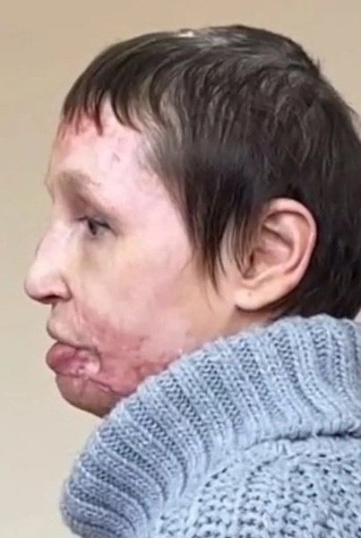 Мужчина изуродовал девушку. Избил и сжег заживо.Женщина еле спаслась от изуверской расправы, ... - 3