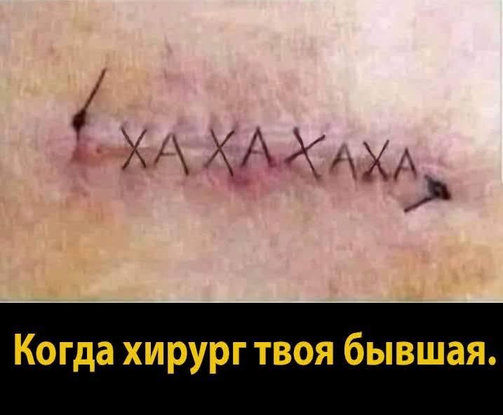 :)