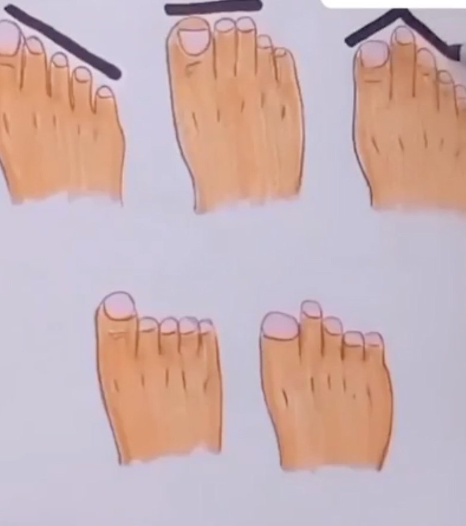   ? - 2