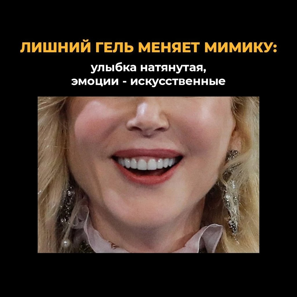    - ,  ,  .  ,    ... - 5