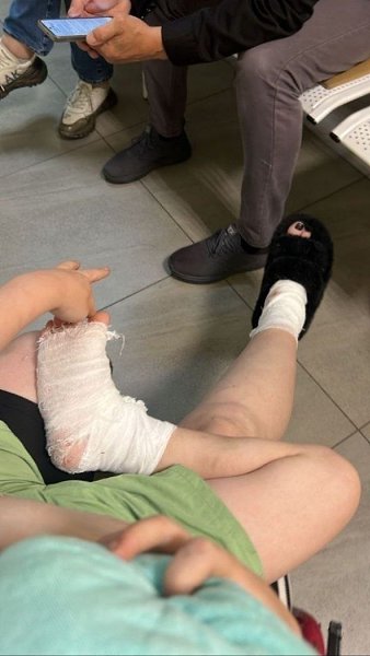 Владивосток: питбуль по команде хозяина напал на женщину с ребенком. Во Владивостоке мужчина ... - 3
