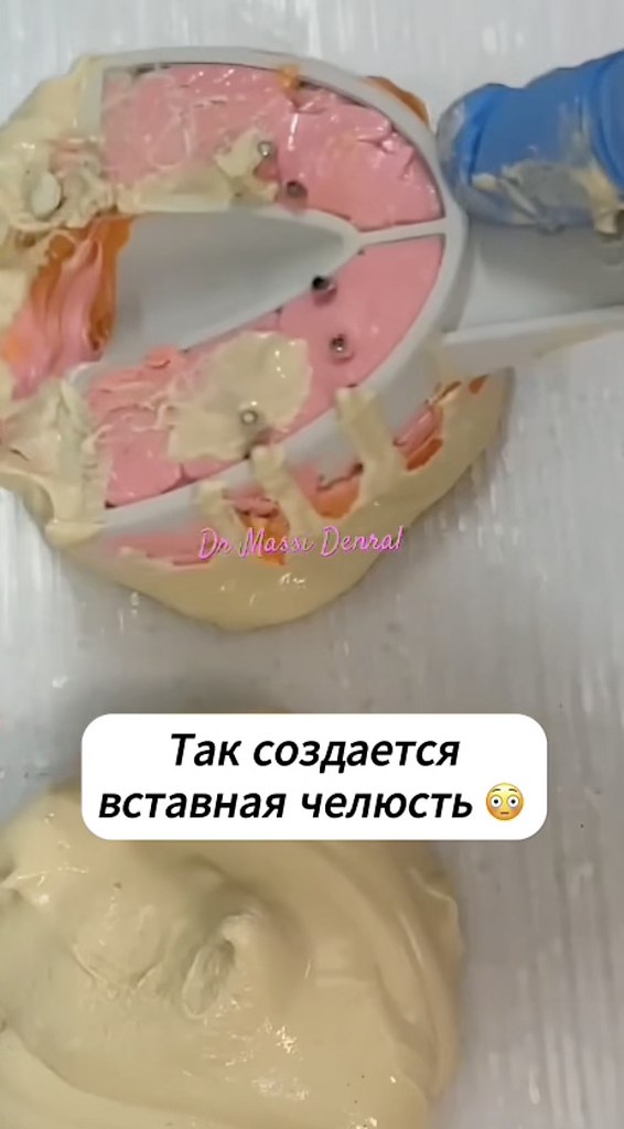     - 2