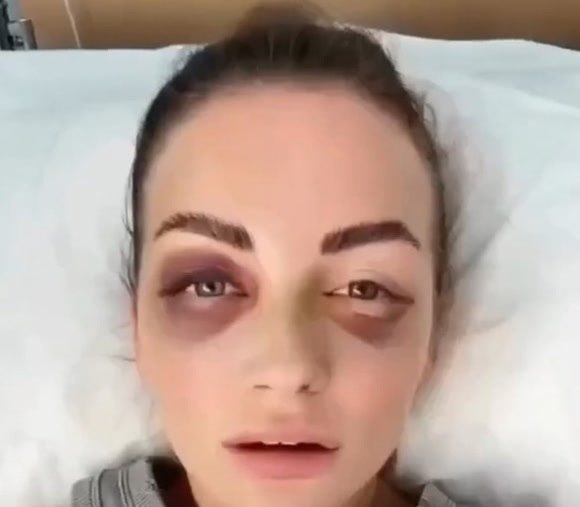 Отказ от интимной близости стал причиной жестокого избиения.Вместо романтического вечера встреча с ...