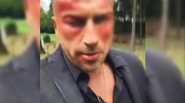 Нагиев подрался, на этот раз все серьезно.Вчера на съёмочной площадке произошёл инцидент, который ... - 2