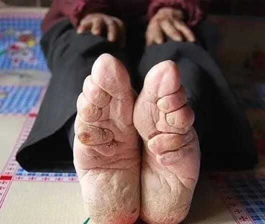 :)      (Lotus Feet)     ...