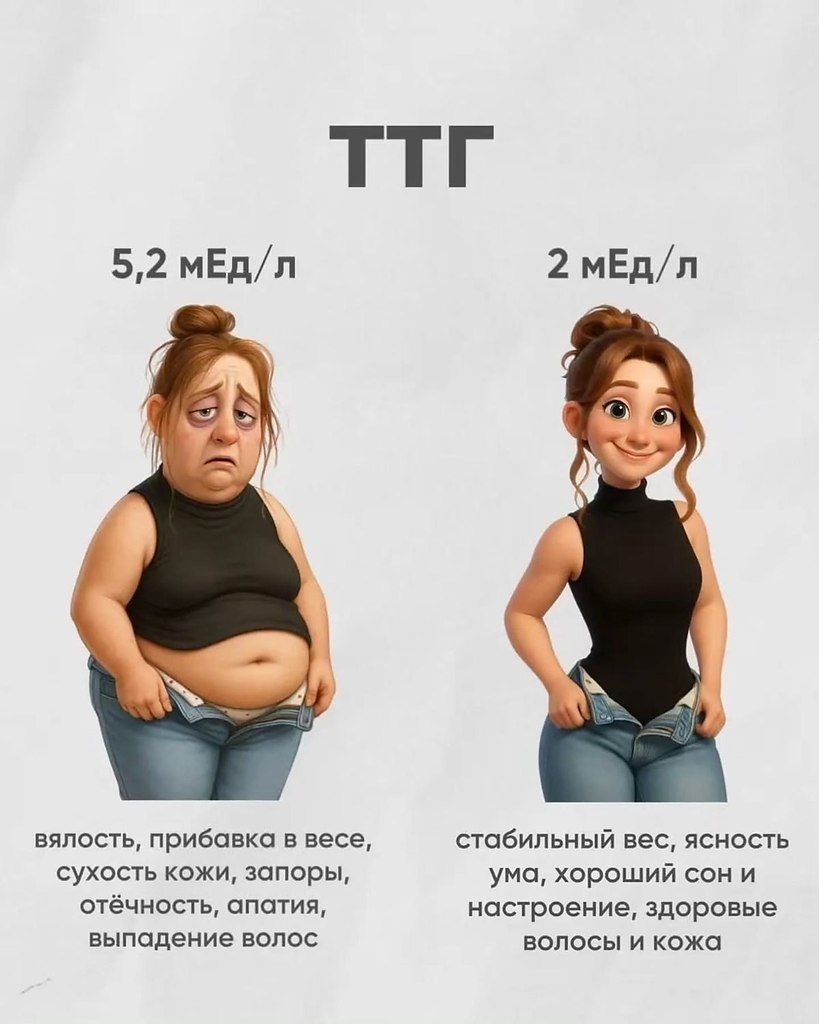            - 3