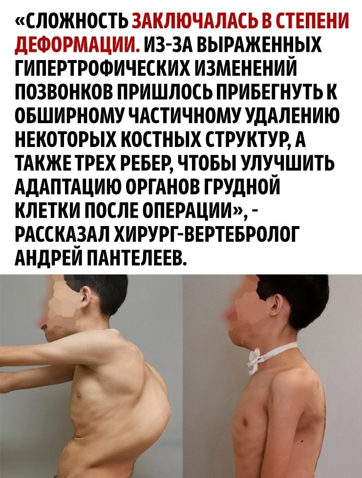      - 3